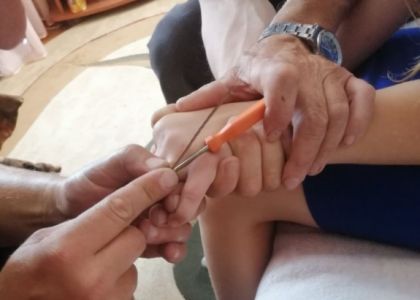 В Ошмянском районе спасатели сняли застрявшее кольцо с пальца ребенка и рассказали, что делать в таких случаях